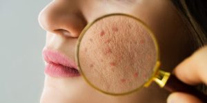 Dermatology